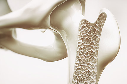 Grafik zeigt offenen Knochen mit sichtbarer innerer Knochenstruktur